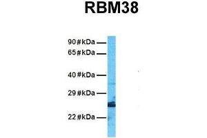 Host:  Rabbit  Target Name:  RBM38  Sample Tissue:  Human A549  Antibody Dilution:  1. (RBM38 anticorps  (N-Term))