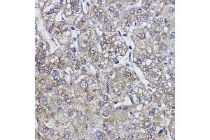 anti-Zinc Finger Protein 259 (znf259) antibody