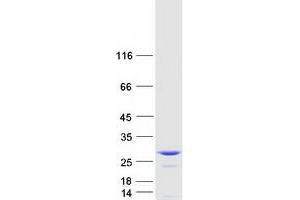 Validation with Western Blot