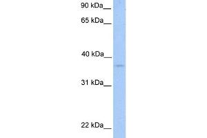WB Suggested Anti-NPAL2 Antibody Titration:  0. (NIPAL2 anticorps  (N-Term))