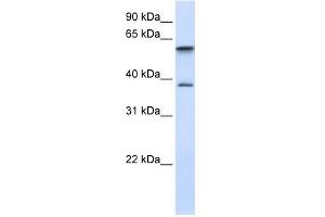 GIMAP5 antibody used at 1 ug/ml to detect target protein. (GIMAP5 anticorps  (Middle Region))