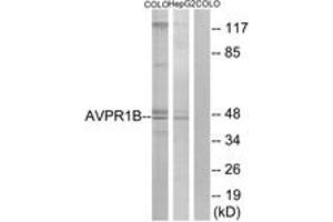 Western blot analysis of extracts from COLO/HepG2 cells, using AVPR1B Antibody. (AVPR1B anticorps  (AA 275-324))