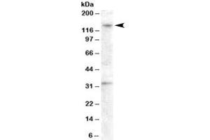 Western blot testing of human ovay lysate with GPR125 antibody at 0. (GPR125 anticorps)