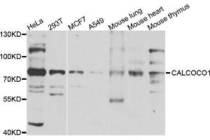Western blot analysis of extracts of various cells, using CALCOCO1 antibody. (CALCOCO1 anticorps)