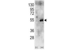Western blot analysis of p70S6Kb antibody and 293 cell lysate (2 ug/lane) either nontransfected (Lane 1) or transiently transfected with the human RPS6KB2 gene (2).