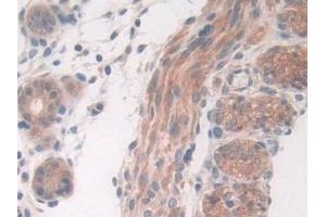 Detection of DDX58 in Mouse Uterus Tissue using Polyclonal Antibody to Probable ATP-dependent RNA Helicase DDX58 (DDX58) (DDX58 anticorps  (AA 1-211))