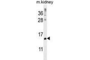 Western blot analysis in mouse kidney tissue lysates (35ug/lane) using MORN5 Antibody (C-term). (MORN5 anticorps  (C-Term))