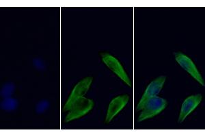 Detection of TUBb in Human HepG2 cell using Anti-Tubulin Beta (TUBb) Monoclonal Antibody