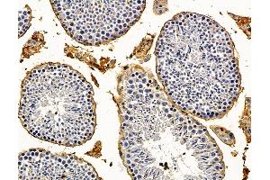 ABIN7095971 and ABIN7100033 at 1/100 staining mouse testis tissue by IHC-P.
