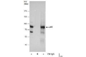 IP Image Immunoprecipitation of p63 protein from A431 whole cell extracts using 5 μg of p63 antibody [N2C1], Internal, Western blot analysis was performed using p63 antibody [N2C1], Internal, EasyBlot anti-Rabbit IgG  was used as a secondary reagent. (p63 anticorps)