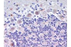 Immunofluorescent staining on Rat Brain sections.