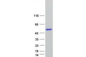 Validation with Western Blot
