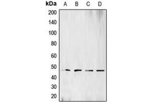 Western blot analysis of BCKDK expression in Raji (A), HeLa (B), Jurkat (C), SHSY5Y (D) whole cell lysates. (BCKDK anticorps  (N-Term))