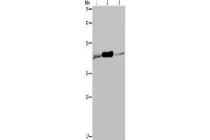 Western Blotting (WB) image for anti-Isocitrate Dehydrogenase 2 (NADP+), Mitochondrial (IDH2) antibody (ABIN2430283) (IDH2 anticorps)