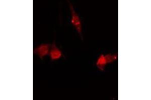 ABIN6278633 staining Hela by IF/ICC. (SLC30A8 anticorps  (Internal Region))