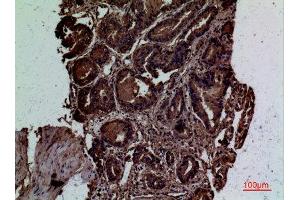 Immunohistochemistry (IHC) analysis of paraffin-embedded Human Prostate Cancer, antibody was diluted at 1:100. (CD300LG anticorps  (Internal Region))
