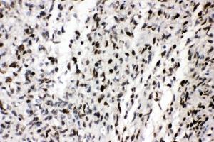IHC analysis of ZEB1 using anti-ZEB1 antibody (ABIN7602984). (ZEB1 anticorps  (Middle Region))