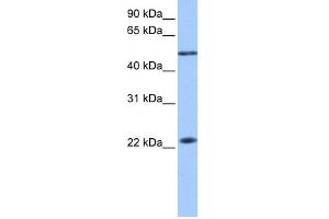 WB Suggested Anti-PIAS2 Antibody Titration: 0. (PIAS2 anticorps  (N-Term))