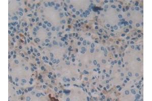 Detection of CR in Human Stomach Tissue using Polyclonal Antibody to Calretinin (CR)