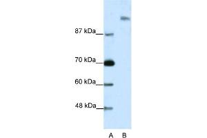 WB Suggested Anti-SUPT6H Antibody Titration:  2. (Spt6 anticorps  (N-Term))