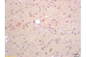 Formalin-fixed and paraffin embedded rat brain labeled with Rabbit Anti DGAT1/Diglyceride acyltransferase Polyclonal Antibody, Unconjugated (ABIN679568) at 1:200 followed by conjugation to the secondary antibody and DAB staining (DGAT1 anticorps  (AA 251-350))