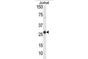 Western blot analysis of CD160 Antibody (Center) in Jurkat cell line lysates (35µg/lane). (CD160 anticorps  (Middle Region))