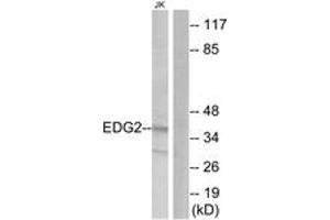 Western blot analysis of extracts from Jurkat cells, using EDG2 Antibody. (BUD31 anticorps  (AA 5-54))