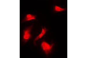 Immunofluorescent analysis of S6K1 (pS418) staining in HeLa cells. (RPS6KB1 anticorps  (C-Term, pSer418))