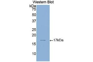 Western blot analysis of the recombinant protein. (Laminin alpha 1 anticorps  (AA 2613-2746))