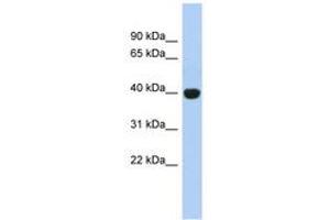 Image no. 1 for anti-KIAA1191 (KIAA1191) (AA 179-228) antibody (ABIN6744040) (KIAA1191 anticorps  (AA 179-228))