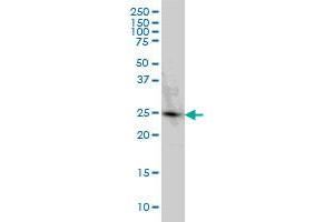 PGRMC2 monoclonal antibody (M04), clone 3C11 Western Blot analysis of PGRMC2 expression in HeLa (PGRMC2 anticorps  (AA 124-223))