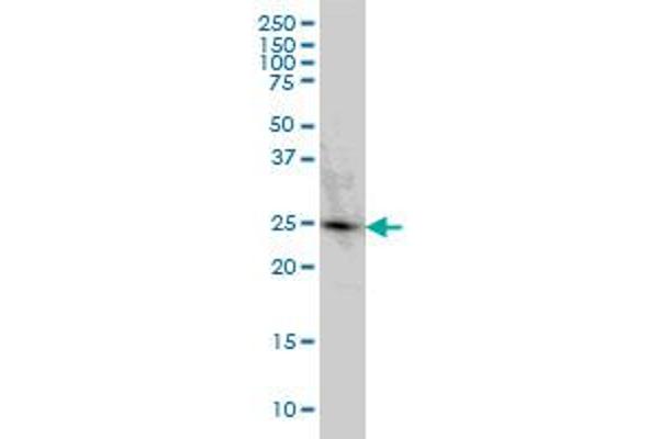 PGRMC2 anticorps  (AA 124-223)