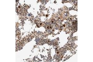 Immunohistochemical staining of human bone marrow with ZBTB34 polyclonal antibody  shows strong nuclear positivity in megakaryocytes. (ZBTB34 anticorps)