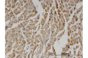Image no. 1 for anti-2,4-Dienoyl CoA Reductase 1, Mitochondrial (DECR1) (AA 236-336) antibody (ABIN599370) (DECR1 anticorps  (AA 236-336))