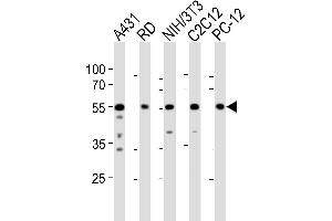 Western blot analysis of lysates from A431, RD, mouse NIH/3T3, mouse C2C12, rat PC-12 cell line (from left to right), using SRC Antibody (N-term) (ABIN1881832 and ABIN2838676). (Src anticorps  (N-Term))