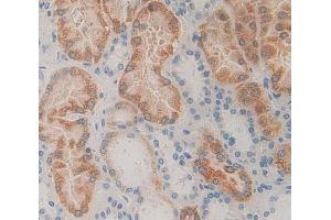 Used in DAB staining on fromalin fixed paraffin- embedded Kidney tissue