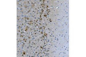 IHC analysis of LSM7 using anti-LSM7 antibody (ABIN7598937). (LSM7 anticorps  (AA 1-103))