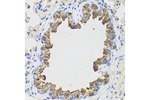 Immunohistochemistry of paraffin-embedded mouse lung using B9D1 antibody. (B9D1 anticorps  (AA 1-130))