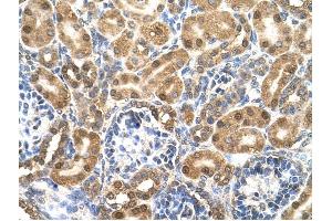Enolase 3 antibody was used for immunohistochemistry at a concentration of 4-8 ug/ml to stain Epithelial cells of renal tubule (arrows) in Human Kidney. (ENO3 anticorps)