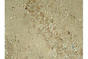 Immunohistochemical analysis of paraffin-embedded rat hippocampal region tissue from a model with Alzheimer