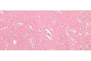 Detection of BACE2 in Human Cortex Tissue using Polyclonal Antibody to Beta Secretase 2 (BACE2)