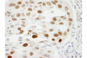 Immunohistochemistry (IHC) image for anti-Importin Subunit alpha-1 (KPNA2) (C-Term) antibody (ABIN7448767) (Importin Subunit alpha-1 (KPNA2) (C-Term) anticorps)