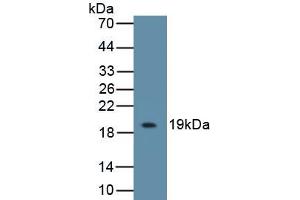 Detection of Recombinant IL18BP, Mouse using Polyclonal Antibody to Interleukin 18 Binding Protein (IL18BP) (IL18BP anticorps  (AA 29-193))