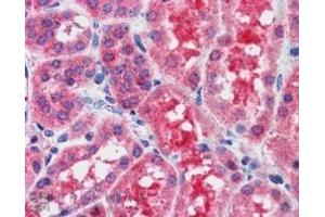 anti-Suppressor of Cytokine Signaling 1 (SOCS1) (C-Term) antibody