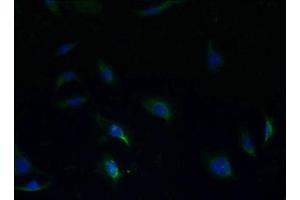 Immunofluorescent analysis of HepG2 cells using ABIN7170565 at dilution of 1:100 and Alexa Fluor 488-congugated AffiniPure Goat Anti-Rabbit IgG(H+L)