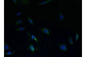 Immunofluorescent analysis of HepG2 cells using ABIN7170565 at dilution of 1:100 and Alexa Fluor 488-congugated AffiniPure Goat Anti-Rabbit IgG(H+L) (S1PR1 anticorps  (AA 311-382))