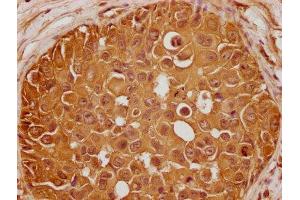 anti-GLI Family Zinc Finger 2 (GLI2) (AA 2-20) antibody