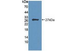 Detection of Recombinant HIPK2, Human using Polyclonal Antibody to Homeodomain Interacting Protein Kinase 2 (HIPK2) (HIPK2 anticorps  (AA 977-1198))