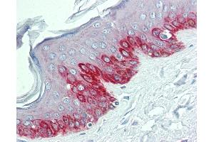 Anti-HDX antibody IHC of human skin. (HDX anticorps  (N-Term))