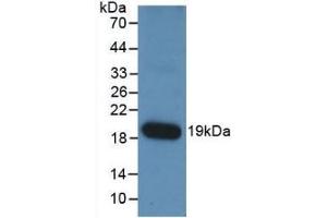 Detection of Recombinant ANGPT1, Human using Monoclonal Antibody to Angiopoietin 1 (ANGPT1) (Angiopoietin 1 anticorps  (AA 284-452))
